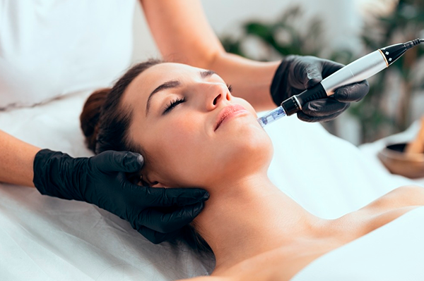 Microneedling