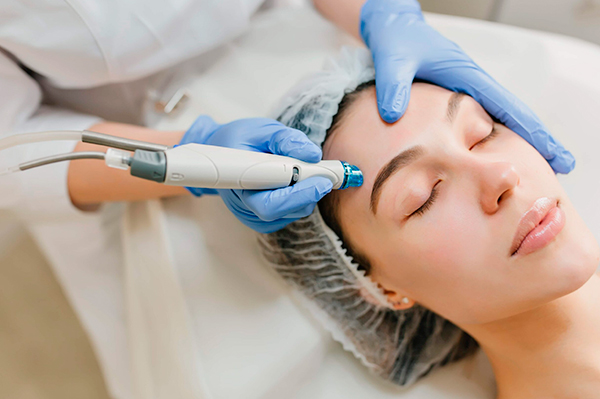 Microneedling