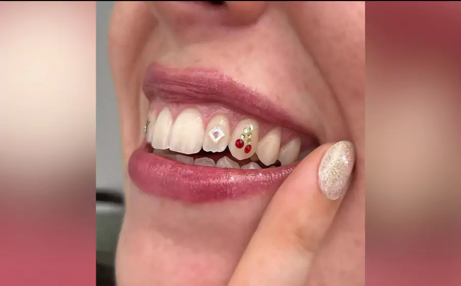 The sparkling trend of tooth gems: why they're taking over